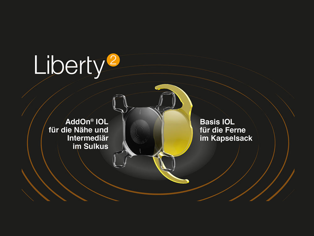 Liberty² – für mehr Brillenunabhängigkeit nach dem refraktiven Linsentausch